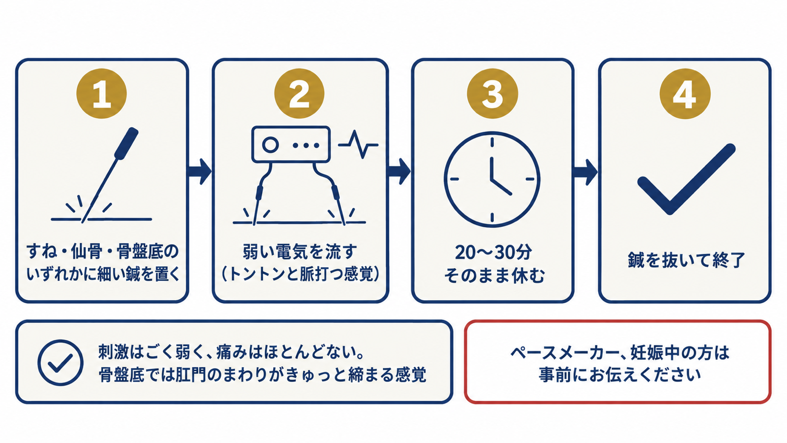 すね・仙骨・骨盤底のいずれかに鍼を置き、弱い電気を流し、20〜30分休み、鍼を抜くという鍼通電の流れと、刺激の弱さやペースメーカー・妊娠中の注意を示す図解