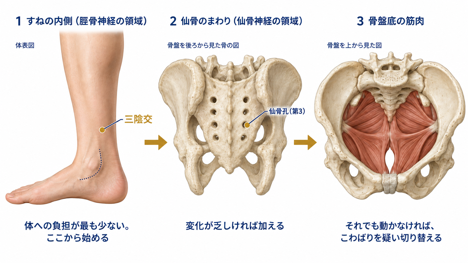 すねの内側から始め、変化が乏しければ仙骨のまわりを加え、それでも動かなければ骨盤底の筋肉へ切り替える3段階のフローチャート